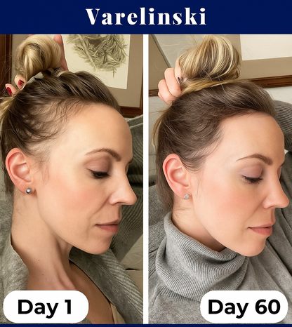 Varelinski HairRevive™ – Gendan tykkere, fyldigere hår på naturlig vis