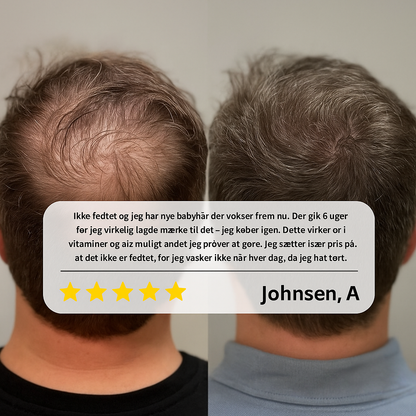 Varelinski HairRevive™ – Gendan tykkere, fyldigere hår på naturlig vis
