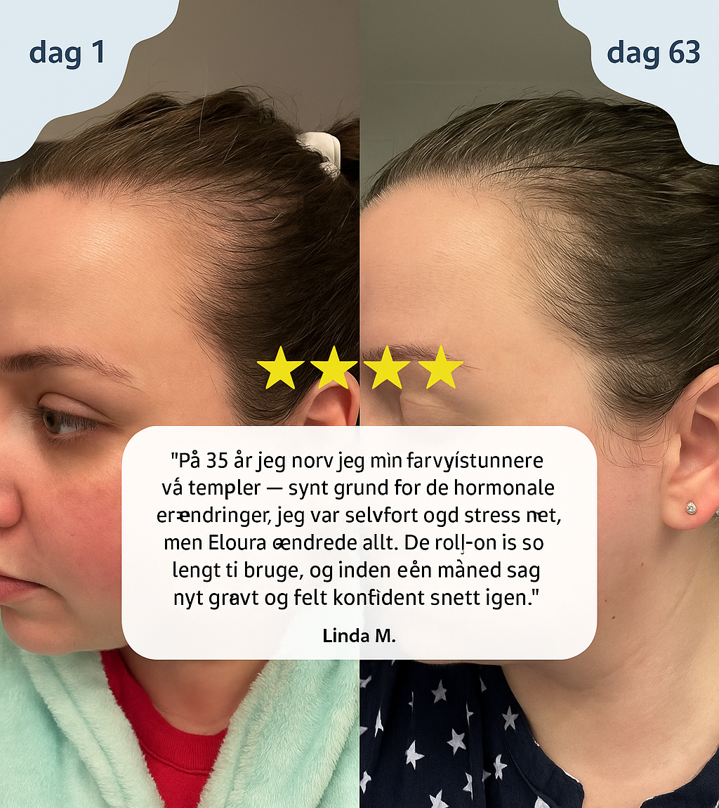 Varelinski HairRevive™ – Gendan tykkere, fyldigere hår på naturlig vis